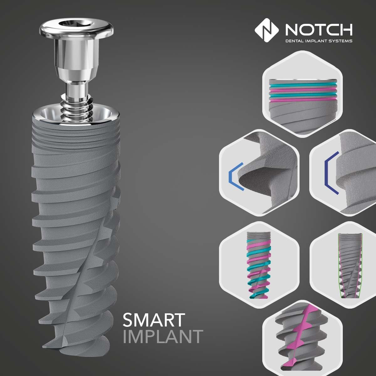 Notch Smart İmplant