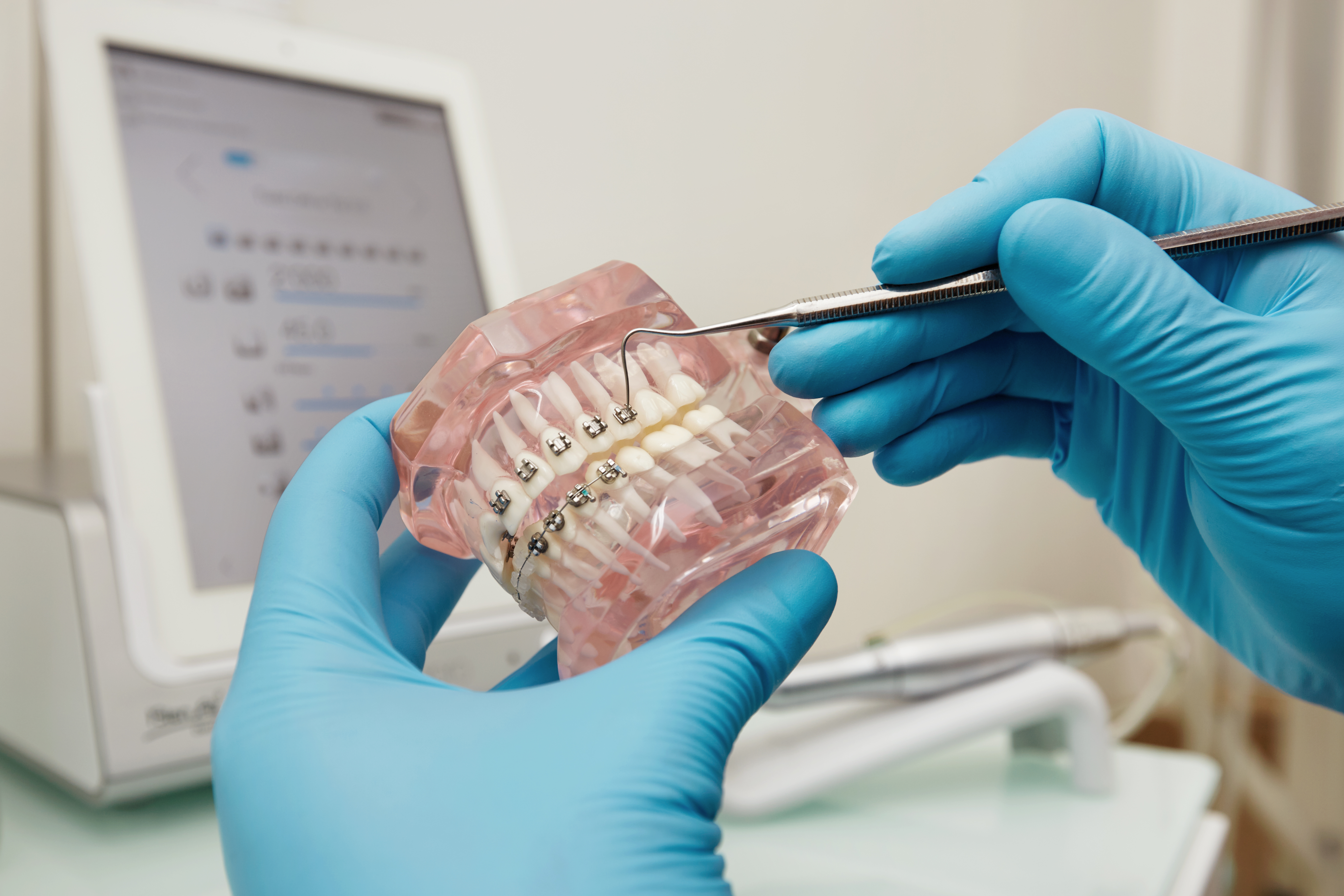 Dental Implant Sistemleri